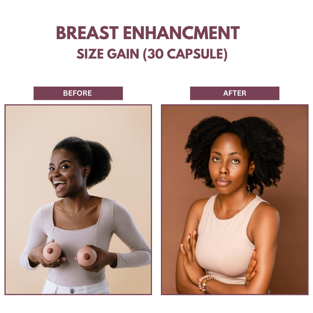 Woman confident with Pure Ayurvedica Breast Enhancement results